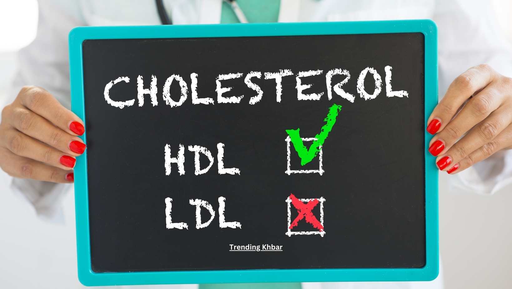 Cholesterol