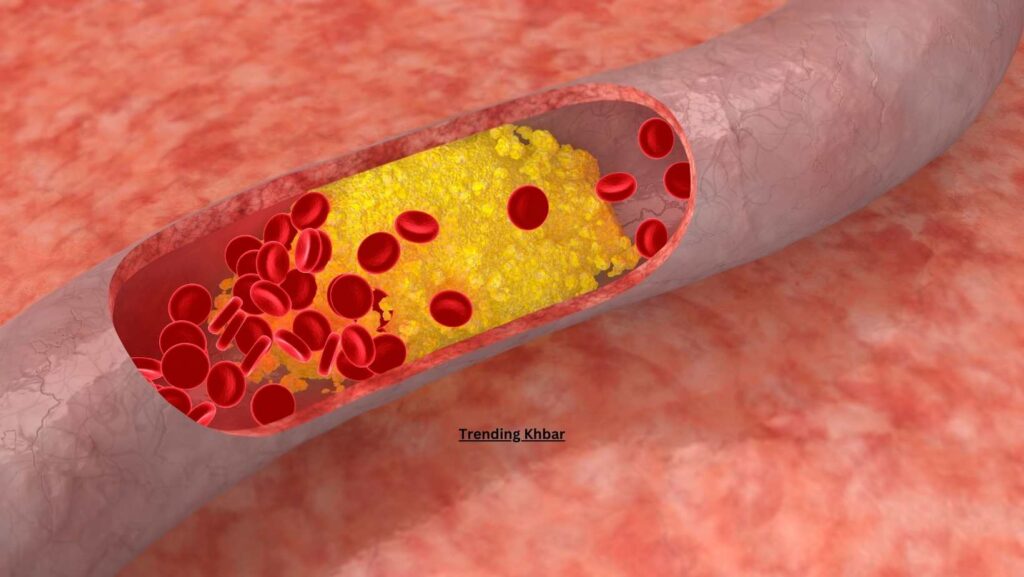 Cholesterol